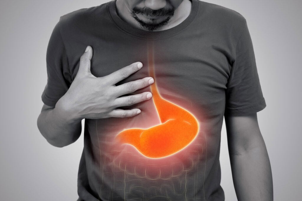 Sure oppstøt, reflux